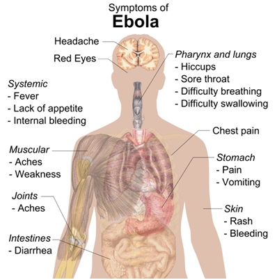 ebola4